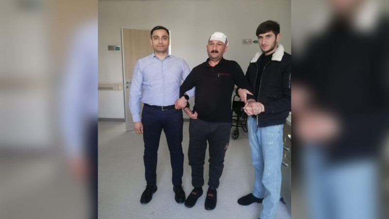 Gəncədə insult keçirən xəstəyə kəllə sümüyü üçün süni implant yaradılıb