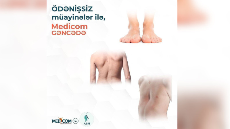 Gəncədə ödənişsiz müayinə təşkil olunacaq
