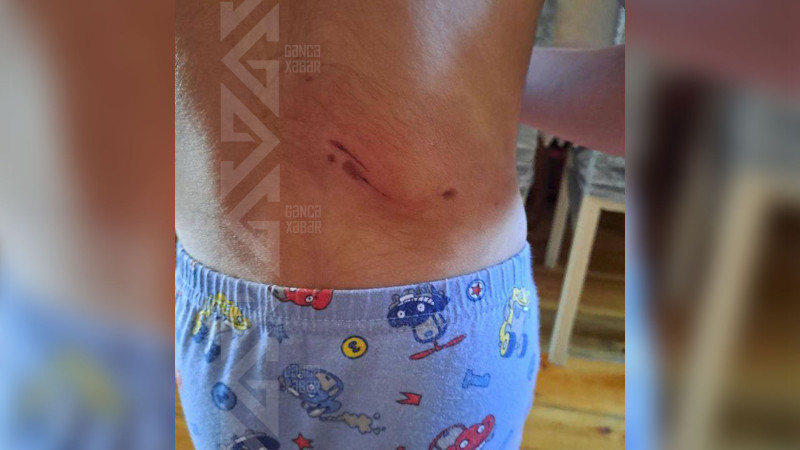 Sakinlər fəvvarələrin işləməməsindən narahatdırlar