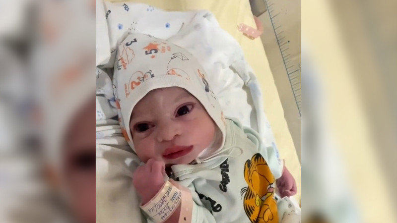 Sosial şəbəkələrdə müzakirə olunan körpənin həkimi açıqlama verib