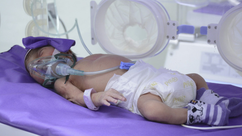 Beynəlxalq Vaxtından Əvvəl Doğulan Uşaqlar Günü keçirilib