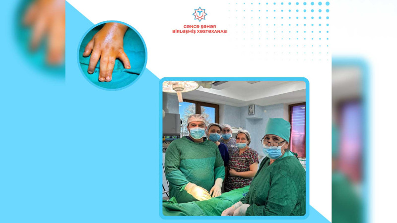 2 yaşlı uşaq sindaktiliyadan əməliyyat olunub