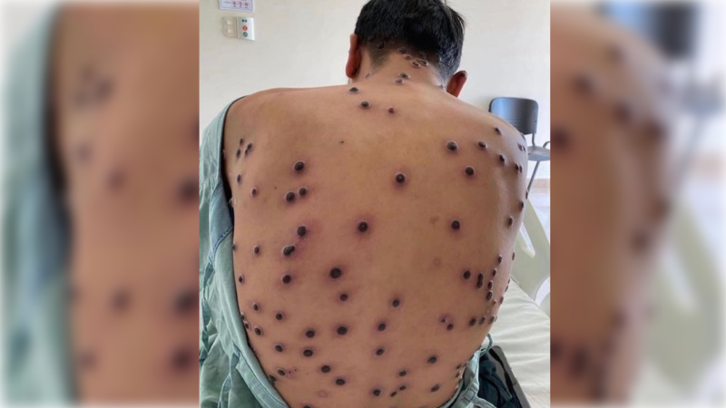 Təhlükəli virusun aşkar edilməsi üçün tədbirlər görülüb