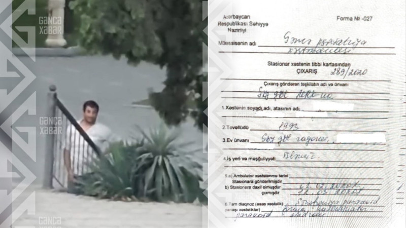 Parkda masturbasiya edən şəxs şizofren imiş…