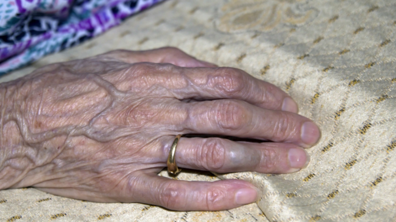 Sirkə turşusu içən 83 yaşlı qadın dünyasını dəyişdi