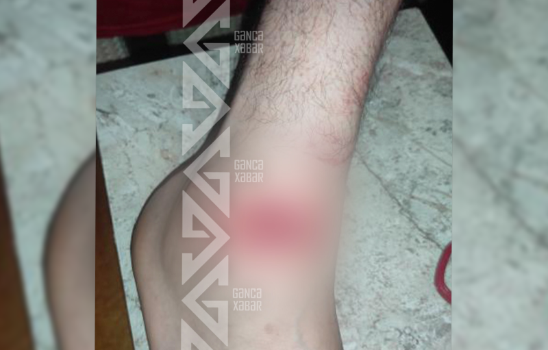 Gəncədə it sürüsü 4 nəfərə xəsarət yetirib