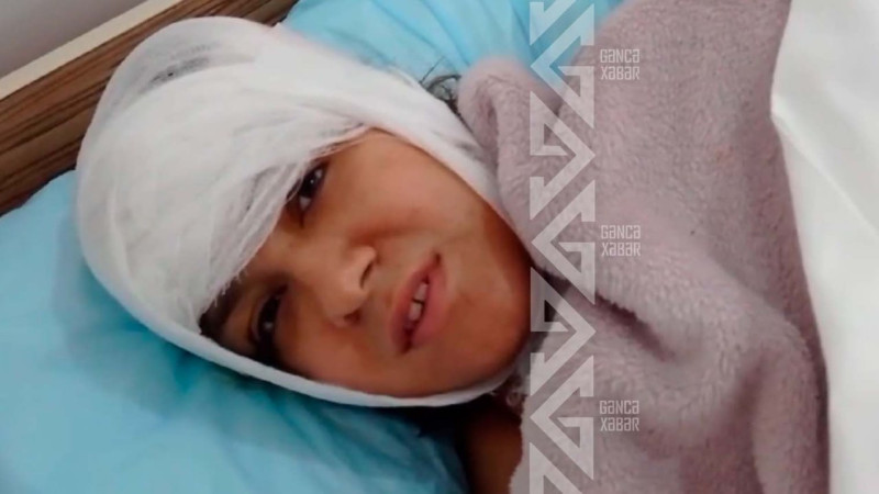 Gəncədəki partlayışda zərərçəkən: 5-ci mərtəbədən 4-ə düşdüm