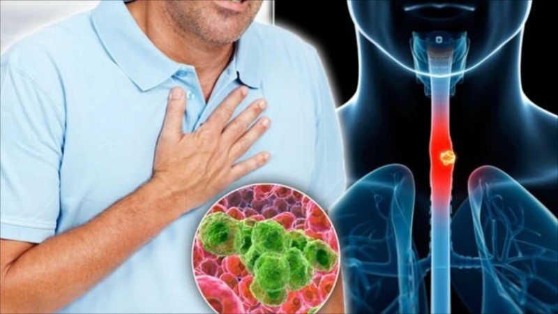 Hər rayonun niyə öz xəstəliyi var? - Səbəblər və çıxış yolları