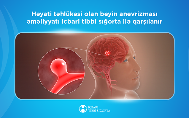 Bu əməliyyat icbari tibbi sığorta ilə qarşılanır