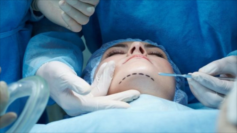 Səhiyyə Nazirliyi plastik cərrahlara müraciət edib