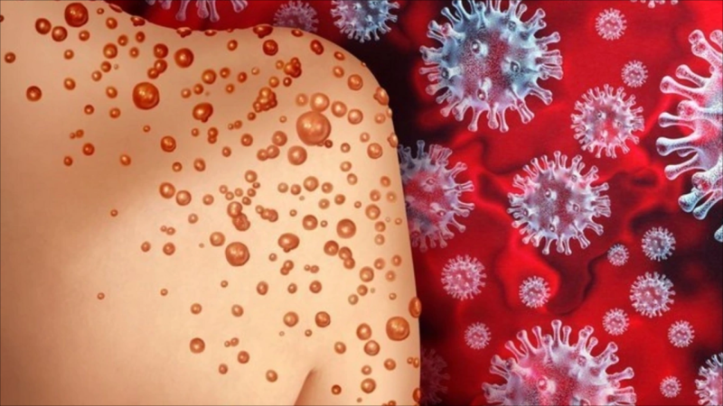 Meymunçiçəyinin əsas əlamətləri və qorunma yolları