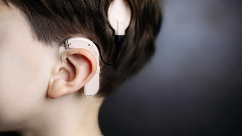 Azərbaycana eşitmə aparatlarının idxalı kəskin azalıb
