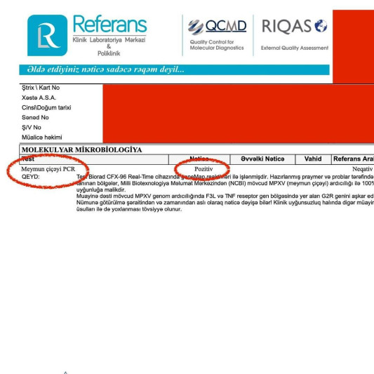 Azərbaycanda ilk meymunçiçəyi diaqnozu qoyan həkimdən PAYLAŞIM - FOTO