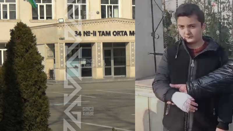 Şagirdin döyülməsi məsələsi araşdırılır