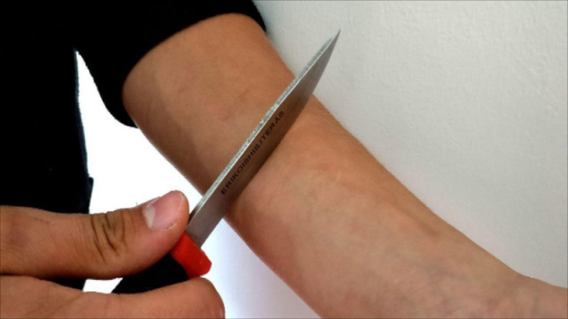 Damarlarını kəsən 18 yaşlı gəncin son durumu məlum olub - YENİLƏNİB