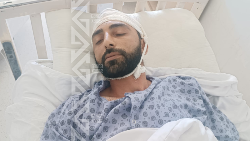 Ofisiant qadın bakalı müştərinin başında sındırdı