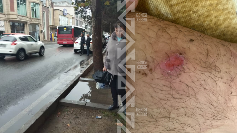 Gəncədə BakuBusın avtobusunda yeniyetmə xəsarət alıb - İDDİA