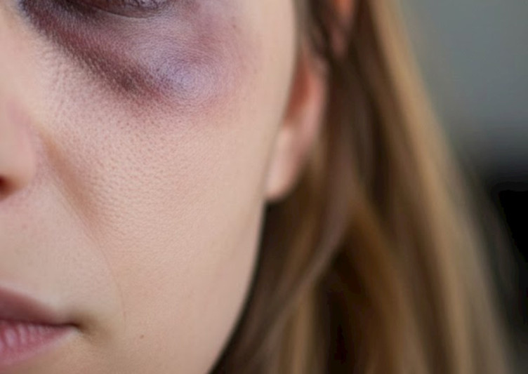 Kişi arvadını gecə ləyənlə döydü