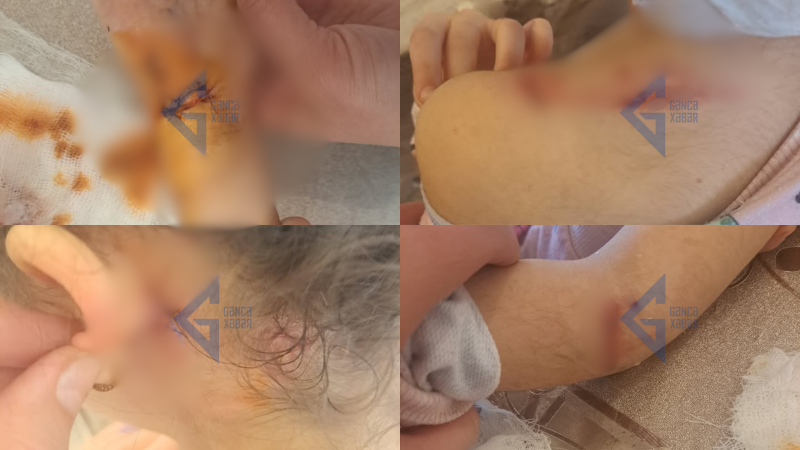 İtlər 6 yaşlı uşağı yerə yıxıb dişlək-dişlək edib…