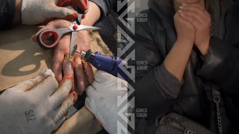 Gəncədə qadının barmağı üzükdən azad edilib