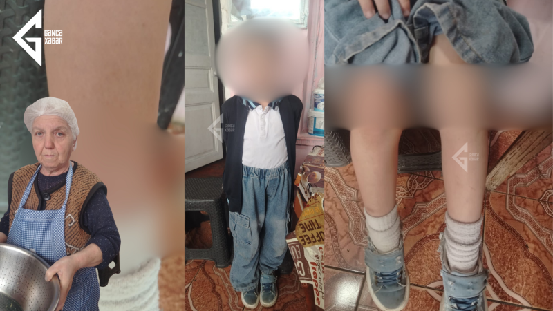 Gəncədə zorakılıq iddiası: Azyaşlılar məktəb TUALETİNDƏ döyülür
