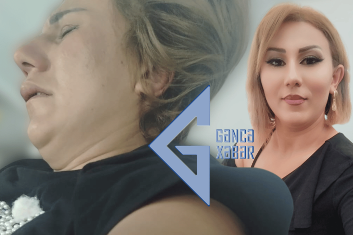 34 yaşlı qadın qaynı tərəfindən amansızcasına döyülüb