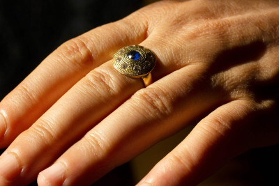 Vətəndaşın barmağında halqa sıxılaraq qalıb