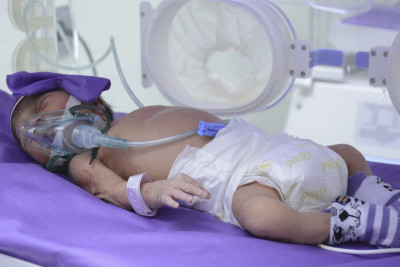 Beynəlxalq Vaxtından Əvvəl Doğulan Uşaqlar Günü keçirilib