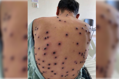 Təhlükəli virusun aşkar edilməsi üçün tədbirlər görülüb