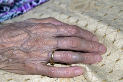 Sirkə turşusu içən 83 yaşlı qadın dünyasını dəyişdi