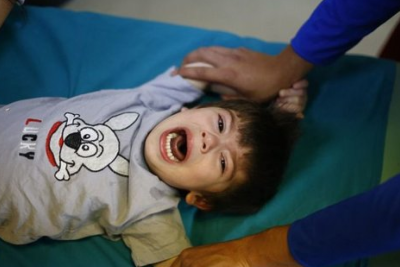 İcbari tibbi sığorta hesabına minlərlə sünnət həyata keçirilib