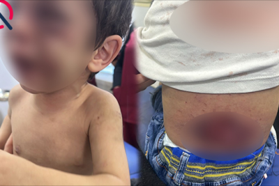 2 yaşlı qızına siqaretlə DAĞ BASAN ögey ata həbs edildi - YENİLƏNİB