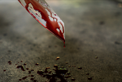 İlk dərs günü məktəbli bıçaqlandı