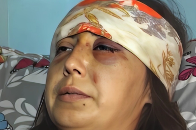 Bətnindəki körpənin cinsiyyəti qız olduğuna görə hamilə qadını döyərək uşağı tələf etdilər