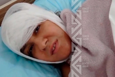 Gəncədəki partlayışda zərərçəkən: "5-ci mərtəbədən 4-ə düşdüm"