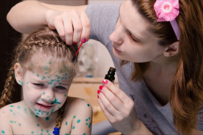 Azərbaycanda uşaqlar arasında suçiçəyi yayılıb