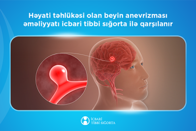 Bu əməliyyat icbari tibbi sığorta ilə qarşılanır