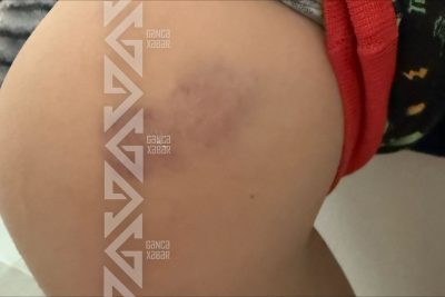 Gəncədə məktəblinin xəsarət alması ilə bağlı araşdırma aparılır - YENİLƏNİB