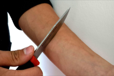 Damarlarını kəsən 18 yaşlı gəncin son durumu məlum olub - YENİLƏNİB