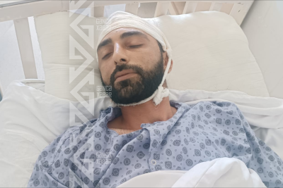 Ofisiant qadın bakalı müştərinin başında sındırdı