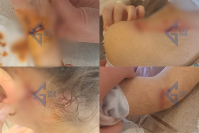 İtlər 6 yaşlı uşağı yerə yıxıb dişlək-dişlək edib…